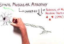 SPINRAZA, SPERANZA IN RITARDO