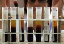 REGIONE TESTA TUTTI I DONATORI TOSCANI IN UN LABORATORIO CHE LEI STESSA DEFINISCE FATISCENTE