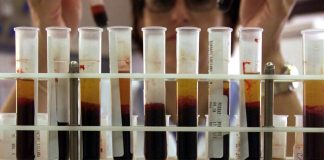 REGIONE TESTA TUTTI I DONATORI TOSCANI IN UN LABORATORIO CHE LEI STESSA DEFINISCE FATISCENTE